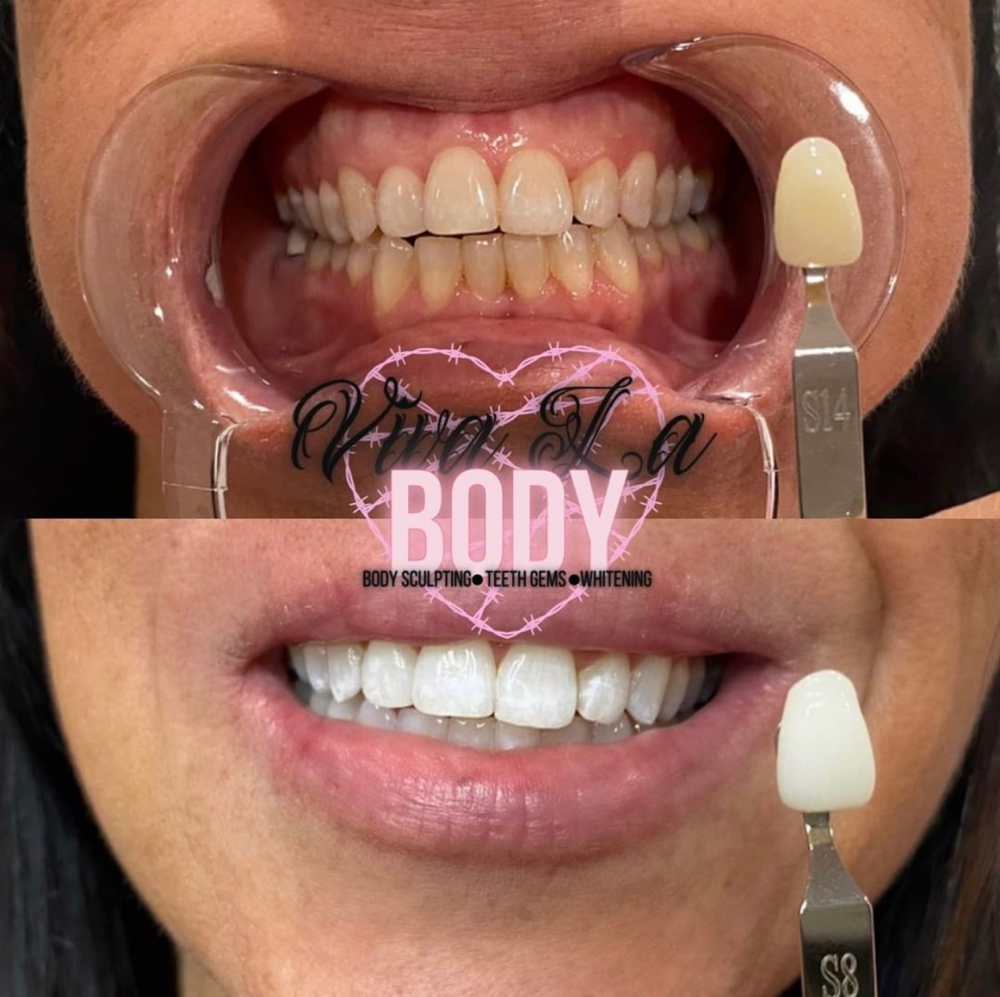 60 Minute Teeth Whitening Session