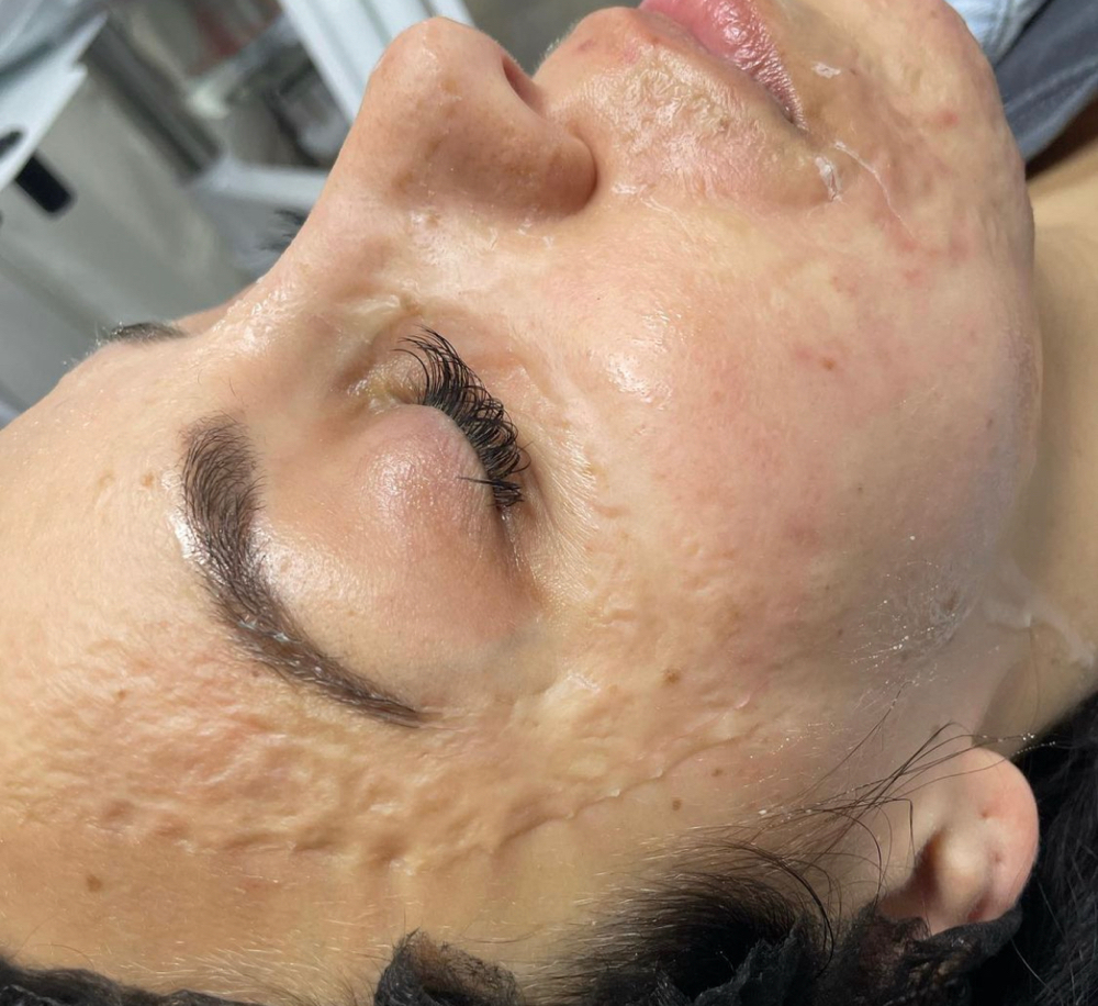 Zombie Contouring Mask