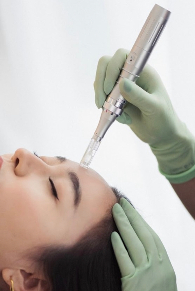 Microneedling Face