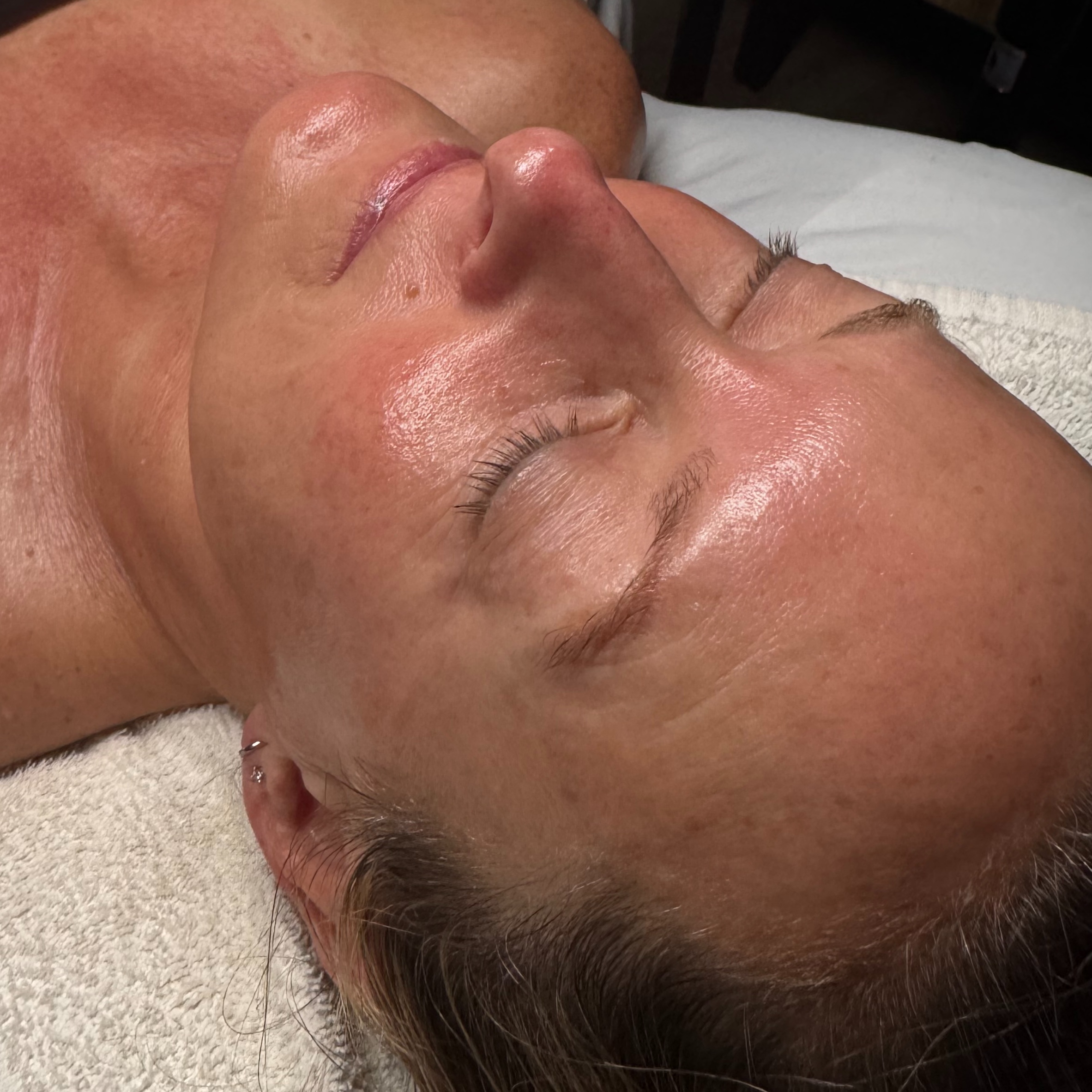 Signature Glow Facial at The Skin Edit LLC in Gulf Shores, AL
