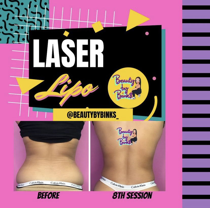 2 Month Laser Lipo Treatment Plan