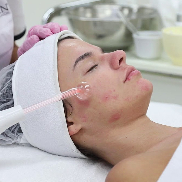 Acne Detox Facial