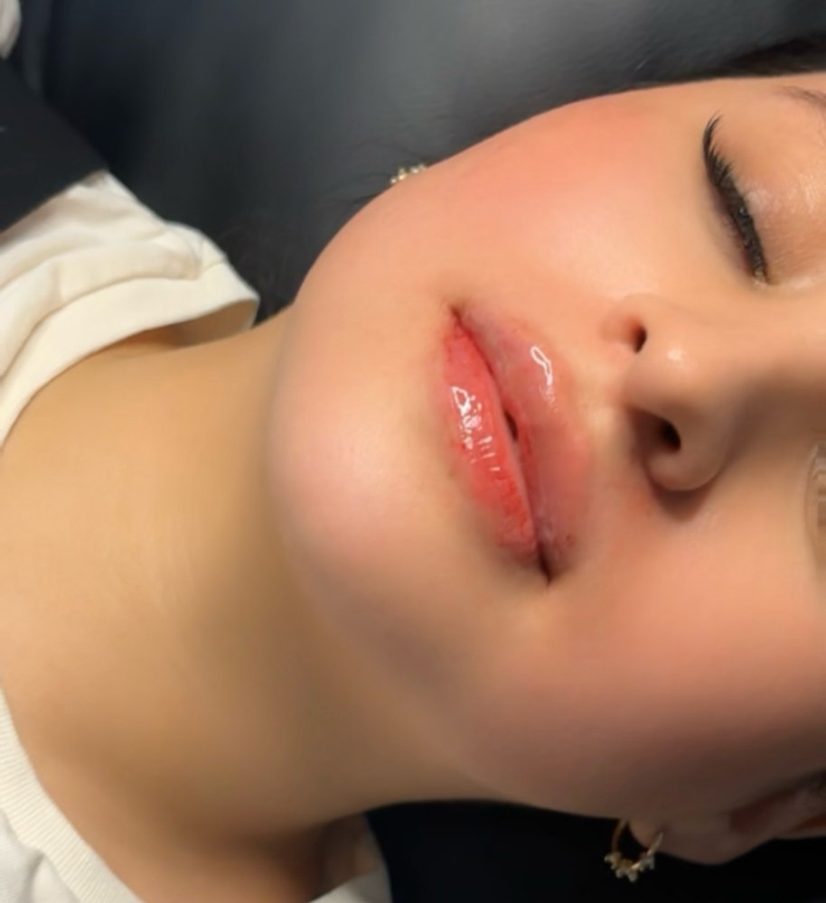 Bhaddie Lip Filler 1ml