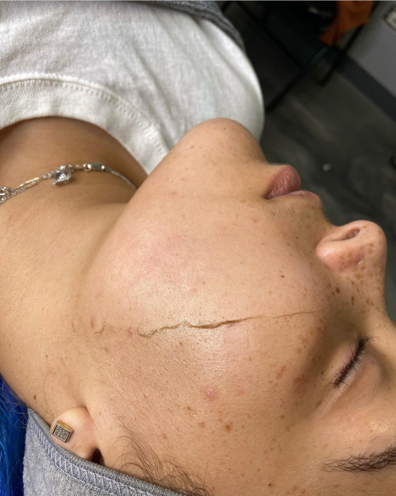 Dermaplaining Delux Facial