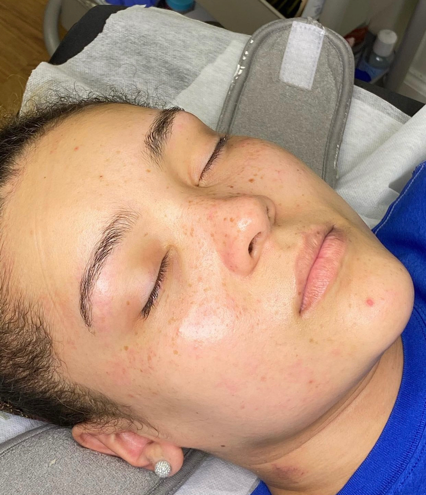 Hydrating facial
