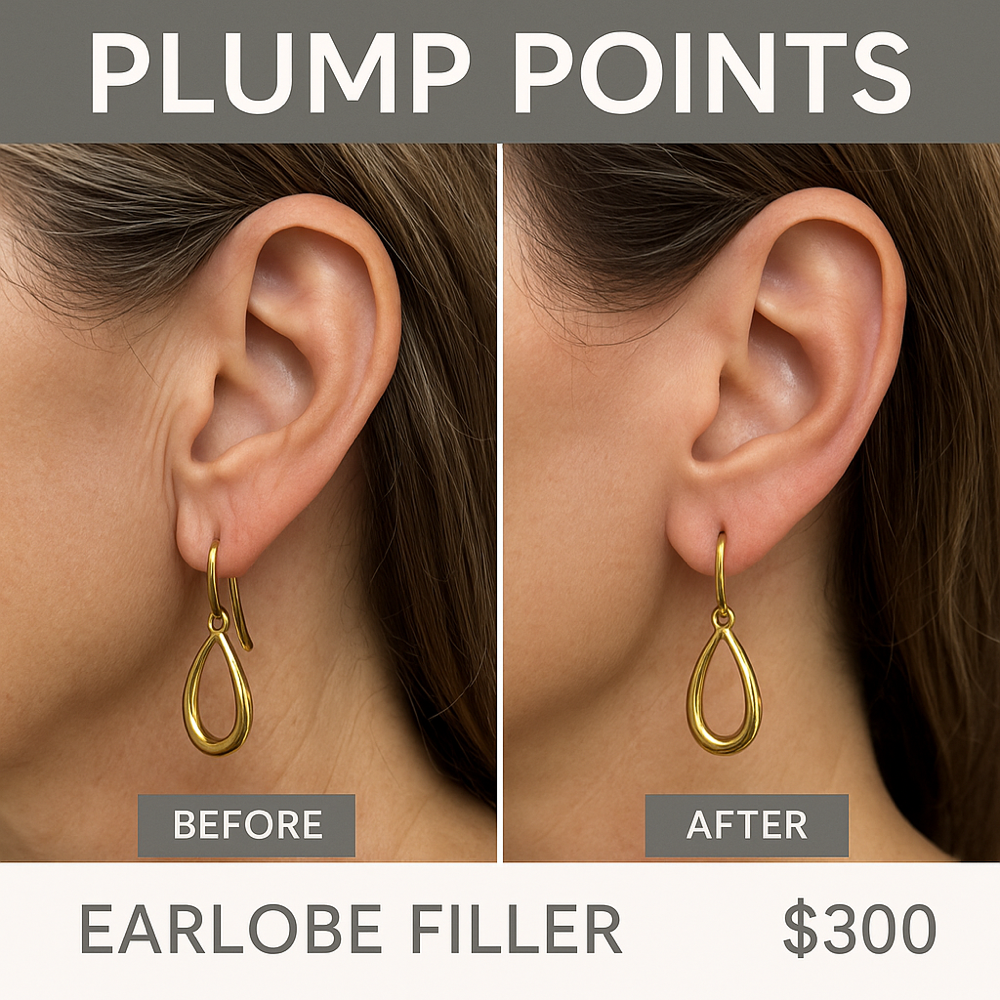 Plump Points™ — Earlobe Filler
