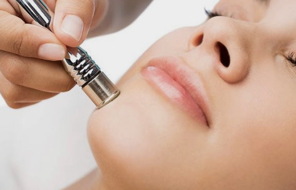 Microdermabrasion