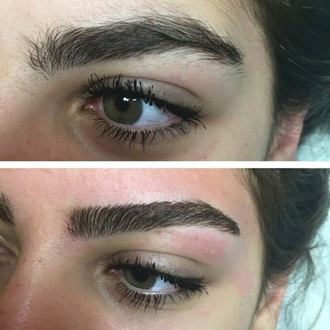 Brow! Are You Serious?