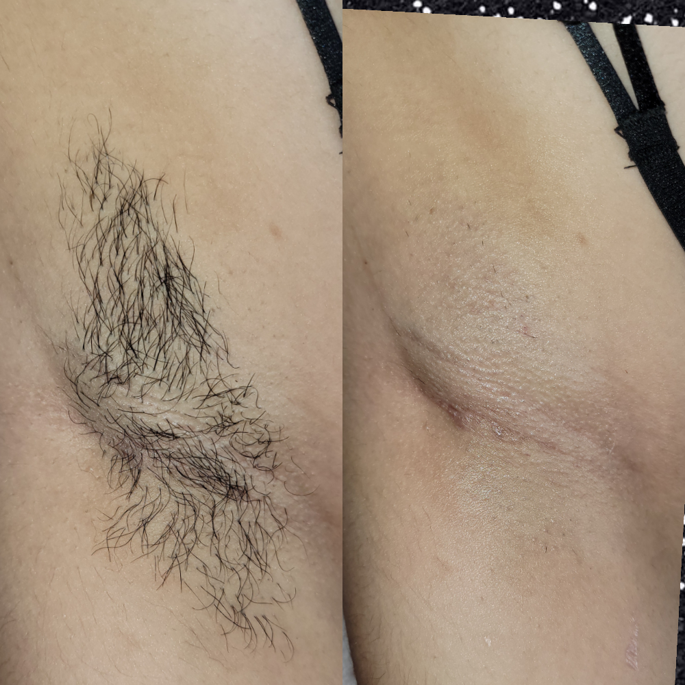 Underarm Wax