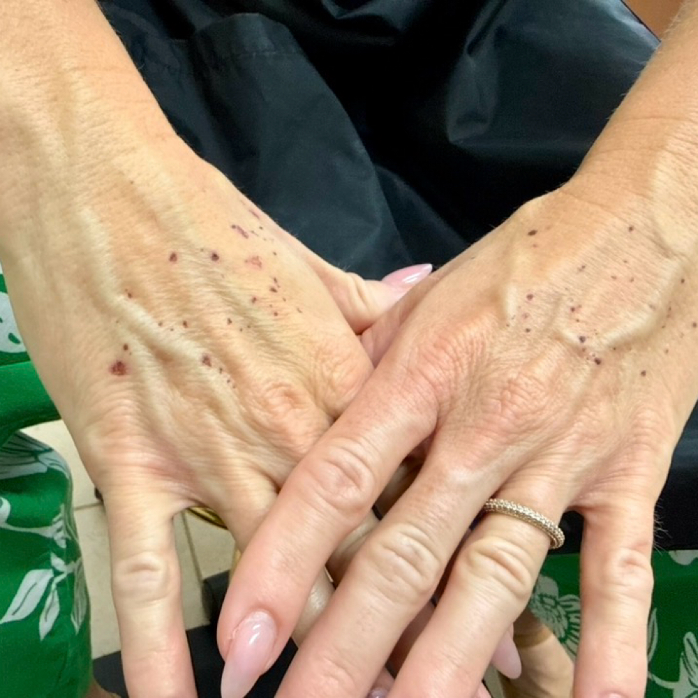 SkinClassic Treatment at Face to Face with Angela in Trinity, FL
