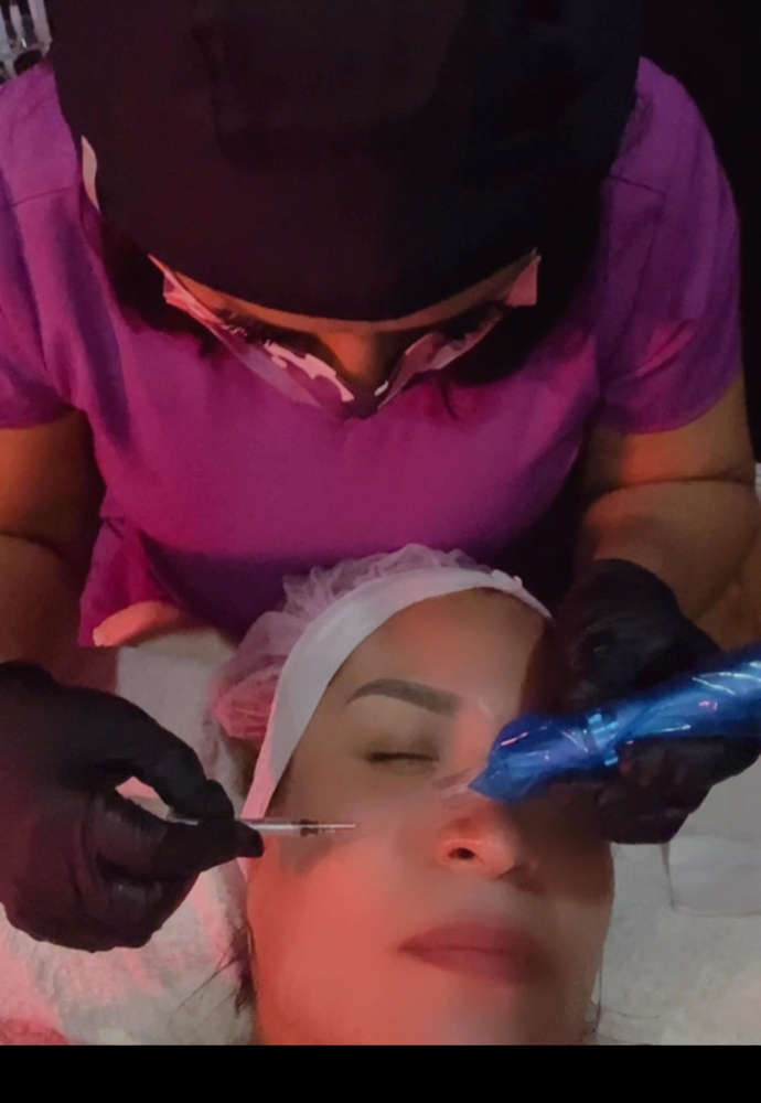 Terapia Regenetmrativa