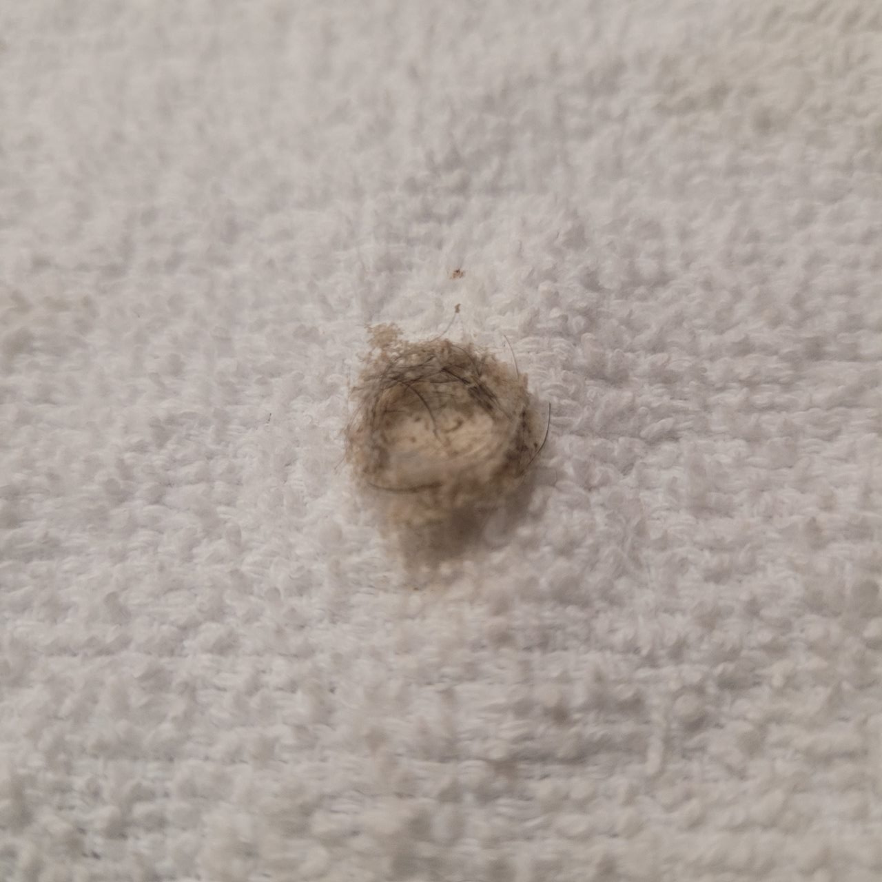 Diamond Microdermabrasion at Anointed Hands Massage & Spa Essentials - Newton in Newton, MA