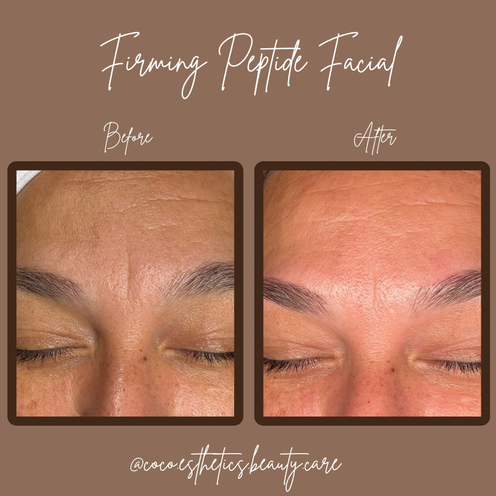 Firming Peptide Facial