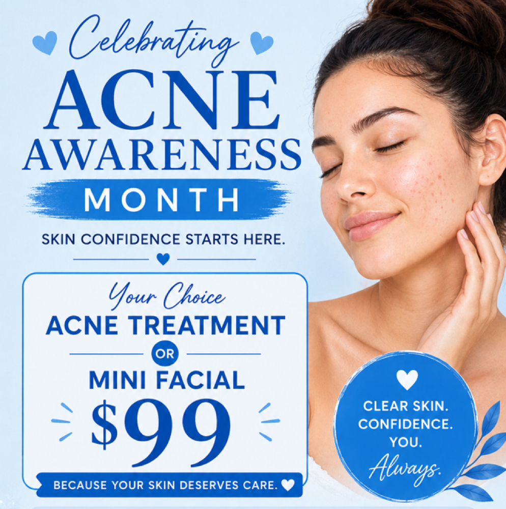June Acne/Mini Facial Special at Carly Larson Esthetics in Temecula, CA