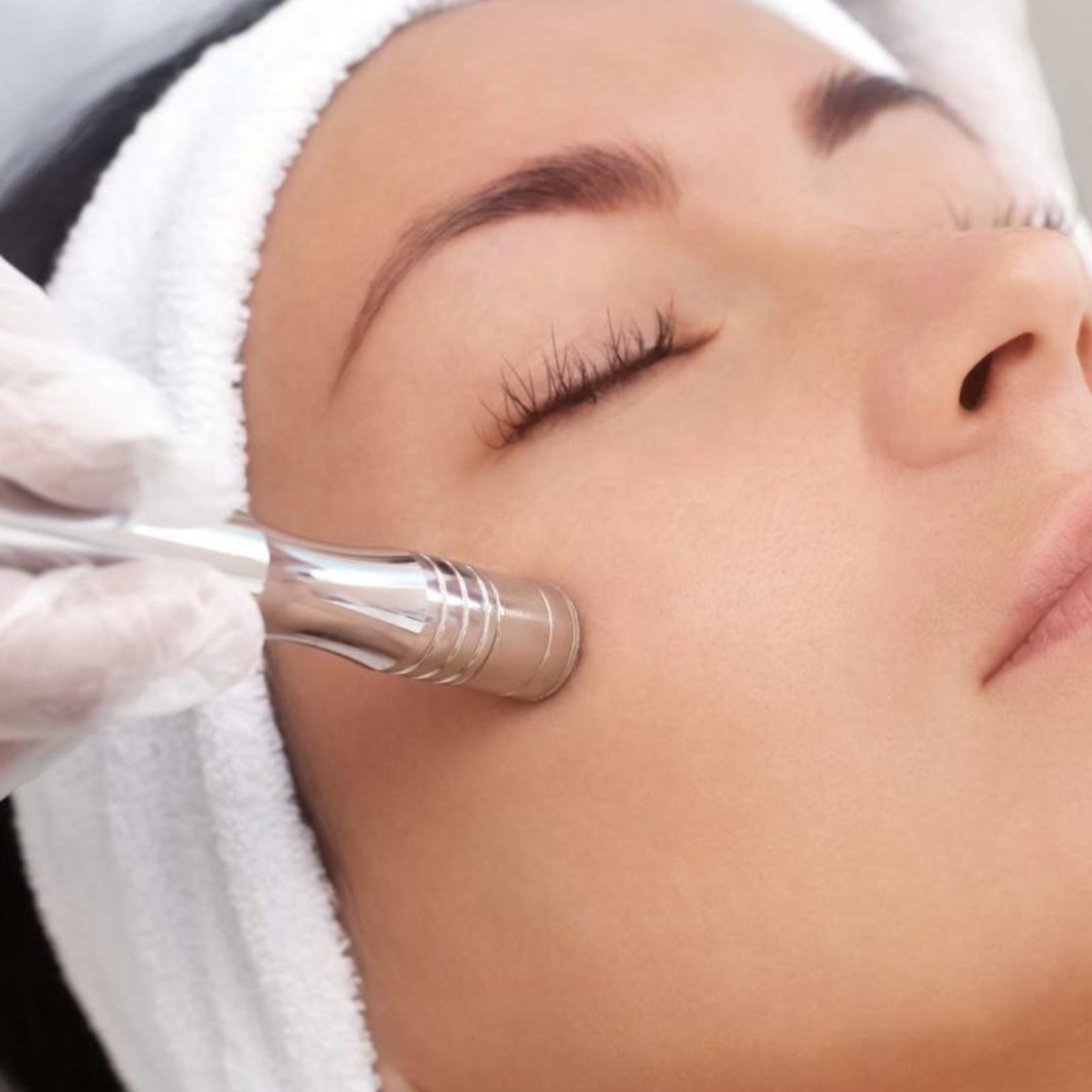 Microdermabrasion Facial at Esthetics With Michaela in Vidalia, LA