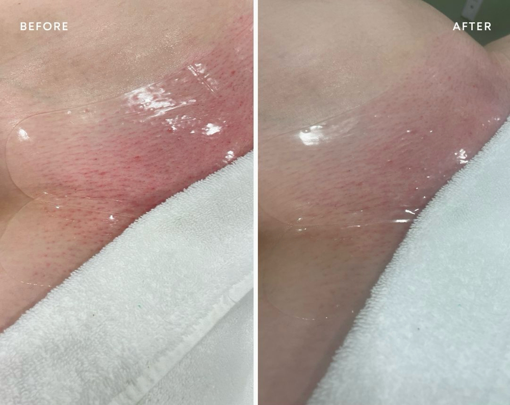 Hydrogel Vajacial Mask (Add-On) at Wax Slayer Studio in Las Vegas, NV