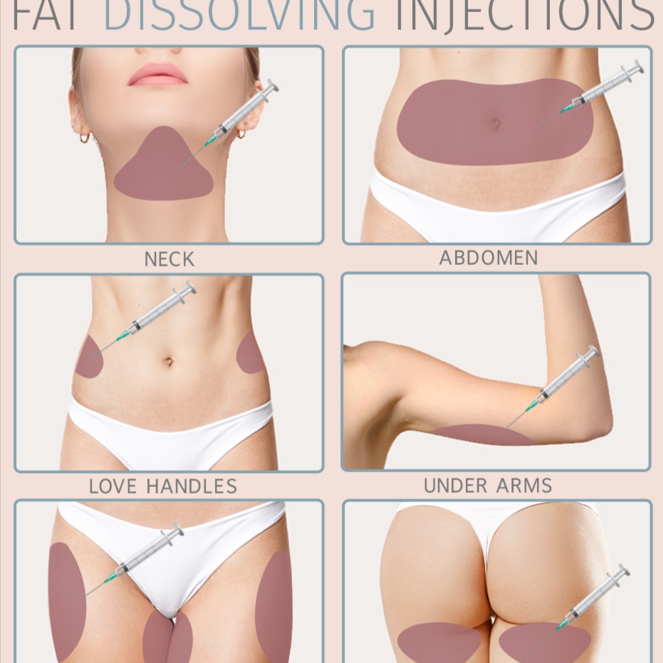 Skinny Shots Lipo (Abdomen)/RF