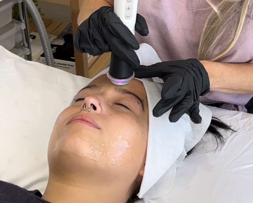 Oxygen Facial