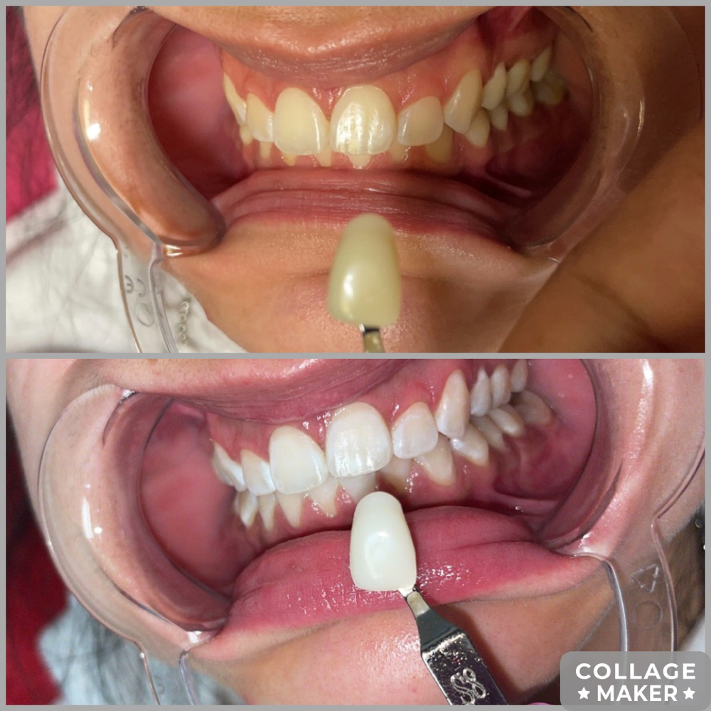Pro Max Gel