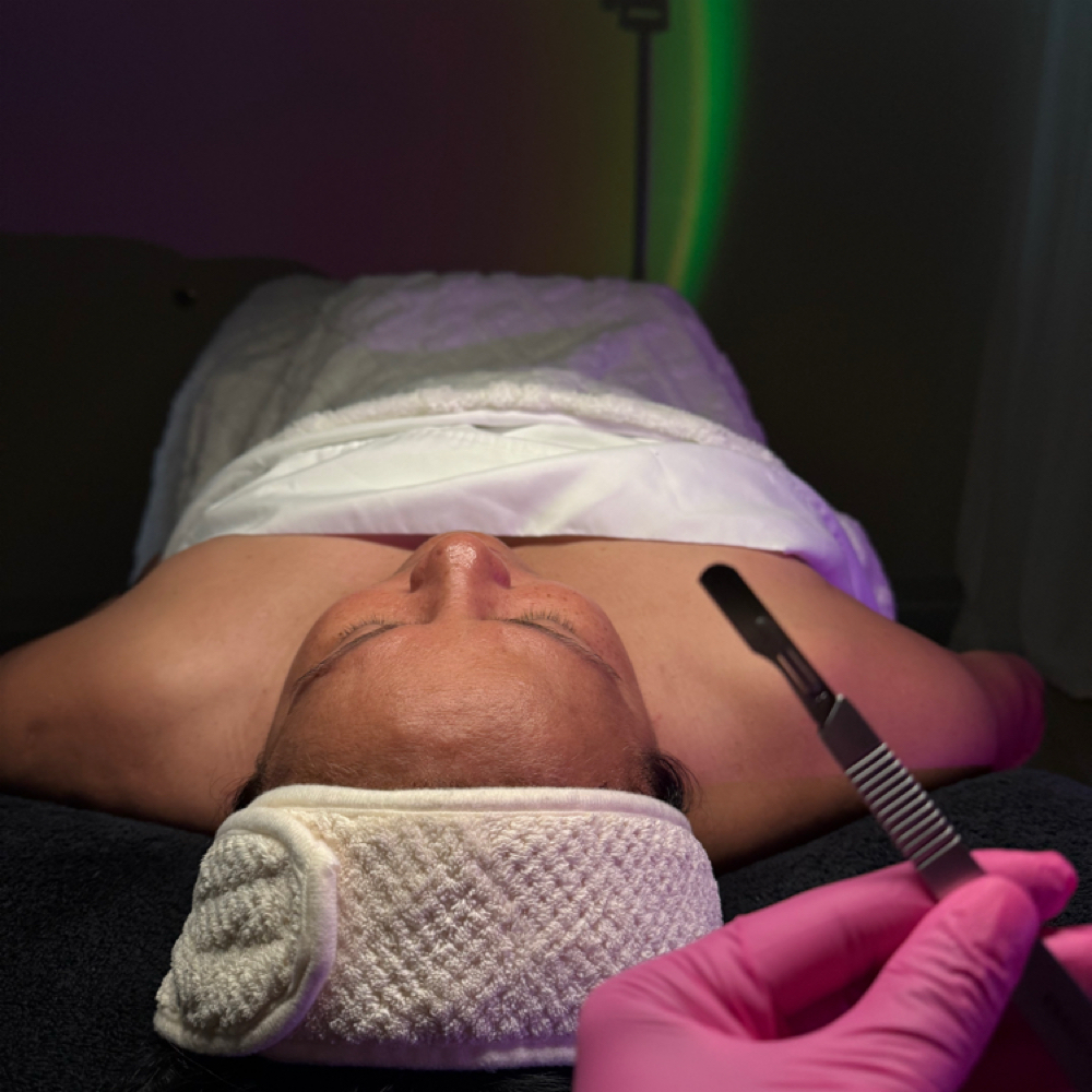 Dermaplaning