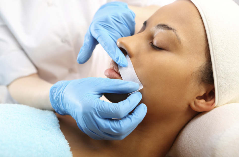 Waxing (Lip)