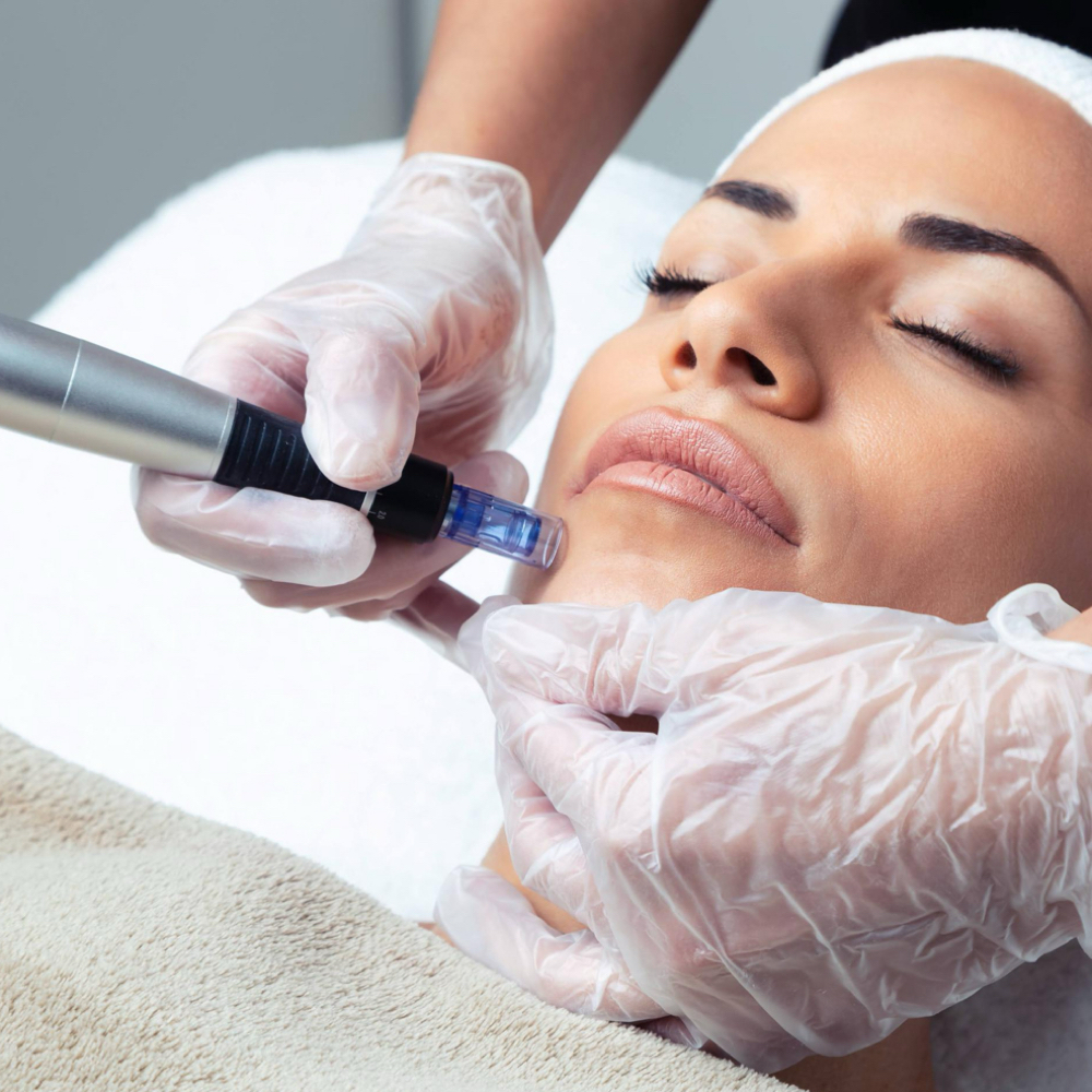 Nano Infusion at Estetica in Venice, FL