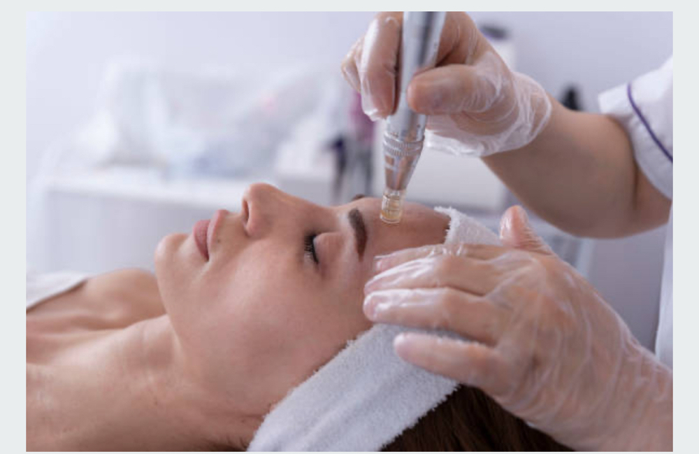 Collagen induction therapy
