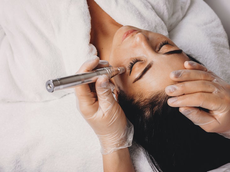 Microdermabrasion  facial