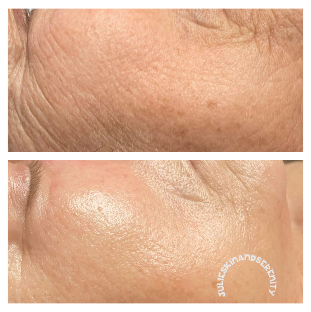 Lux Facial (90 Minute)
