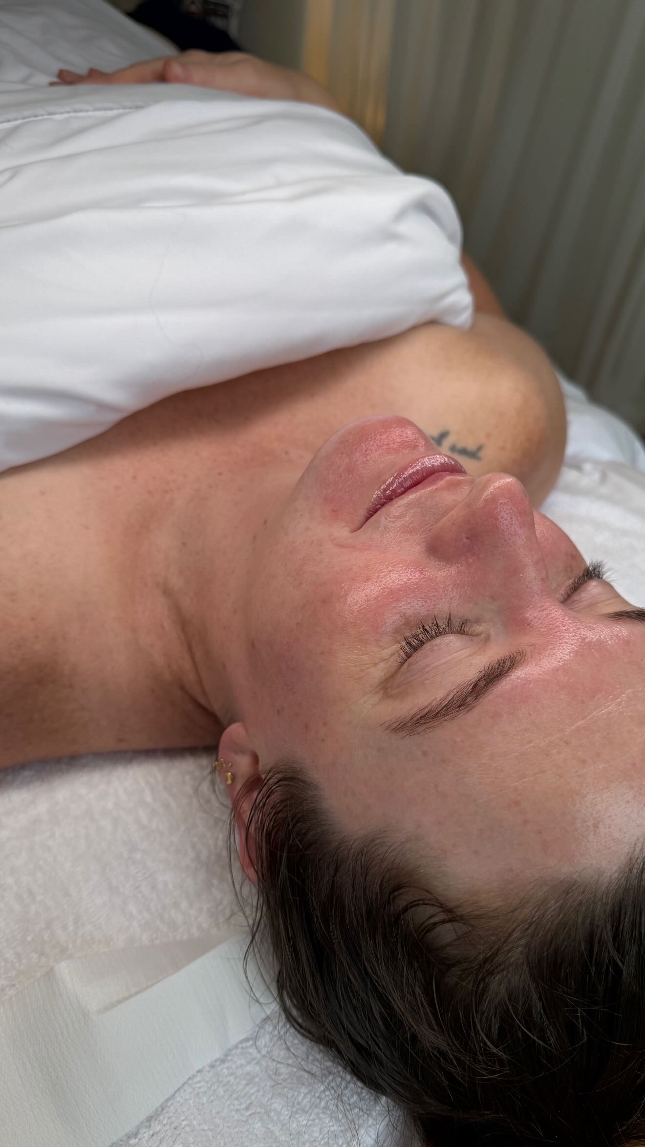30 Min Dermaplane