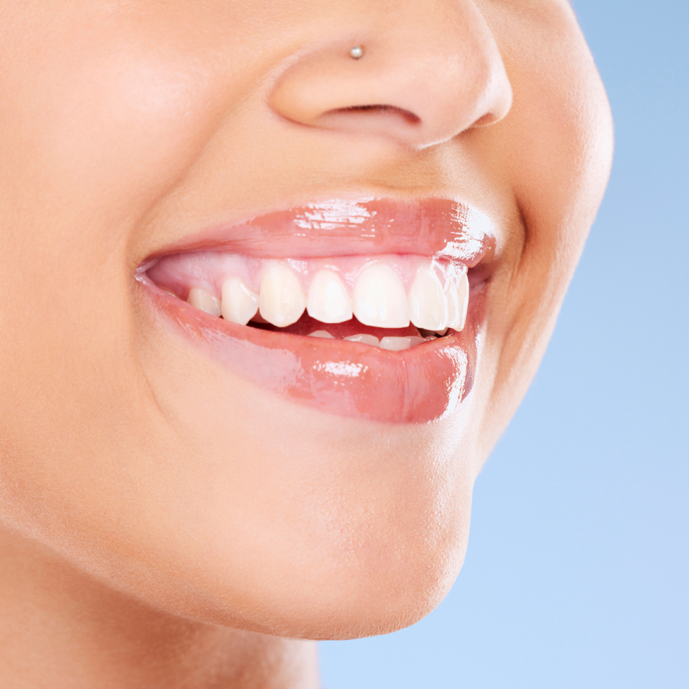 Cosmetic Teeth Whitening