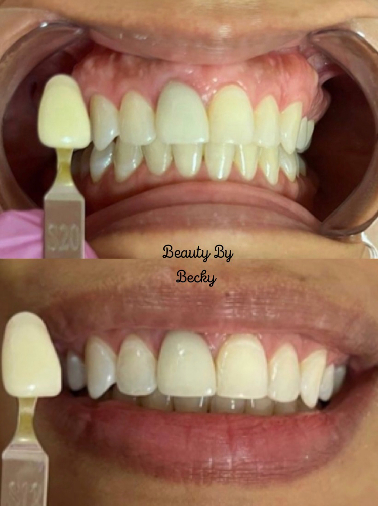 30 Minute Glo Session