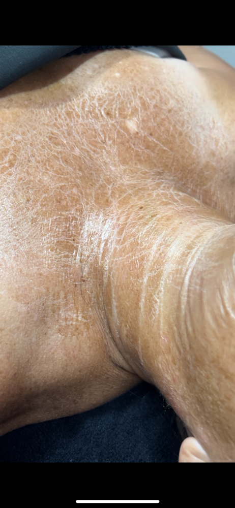 Firming Peptide Facial