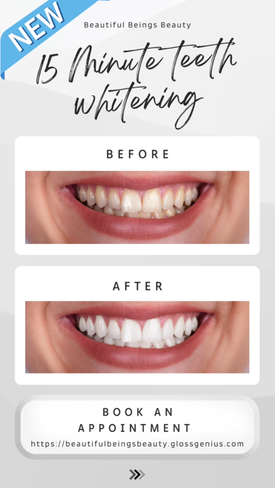 NEW‼️ Teeth Whitening