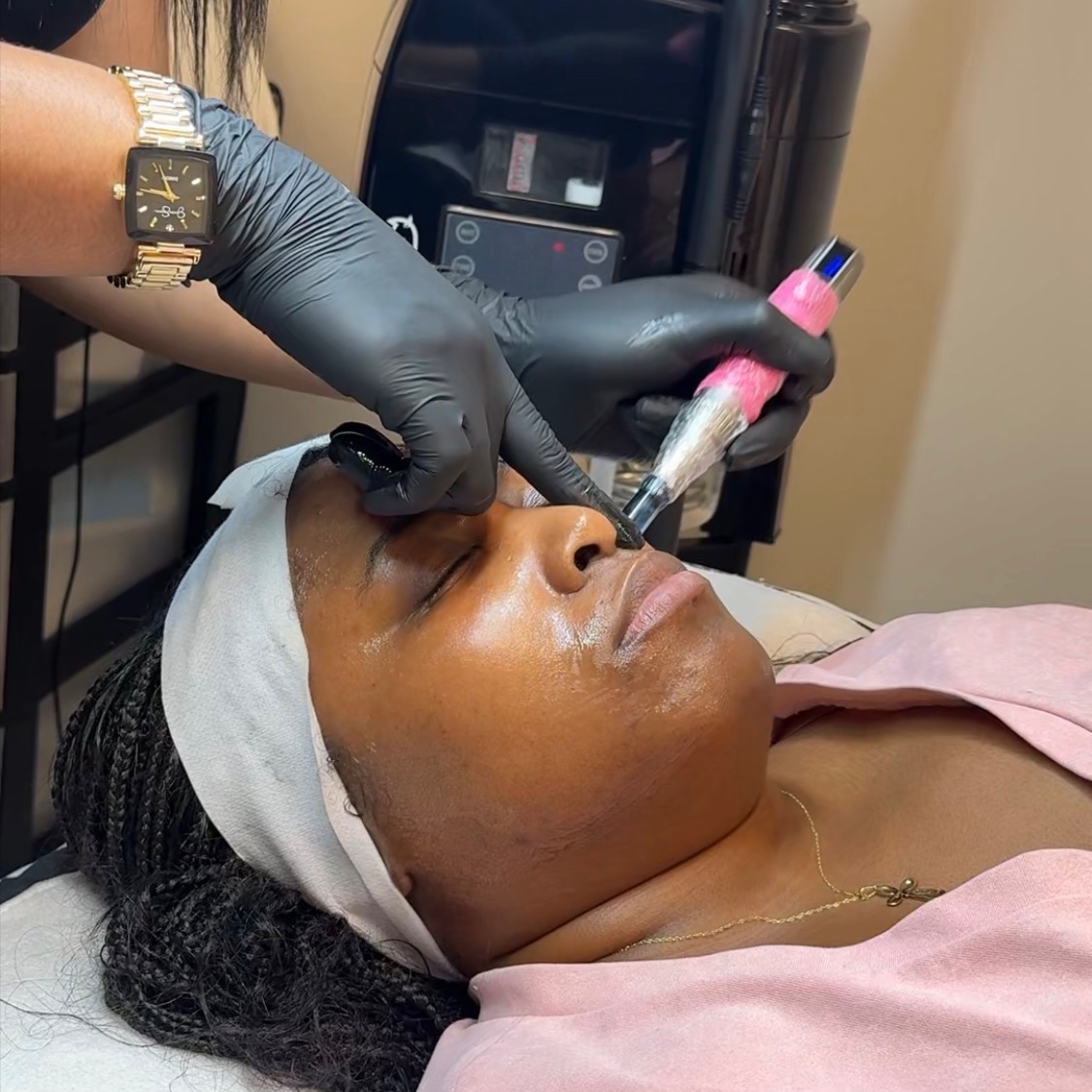 Acne DarkSpot Maintenance Treatment at Glow Aesthetics Studio in Atlanta, GA