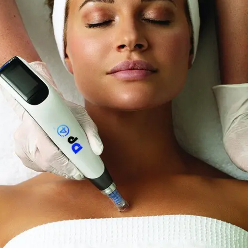 Décolleté Microneedling | Add-On at Arcana Med Spa in Castle Rock, CO