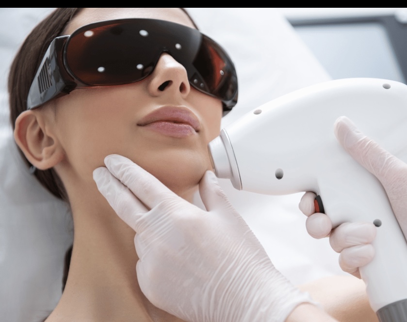 Full Face Laser Hair Removal at M.A.V Aesthetics in Fort Morgan, CO
