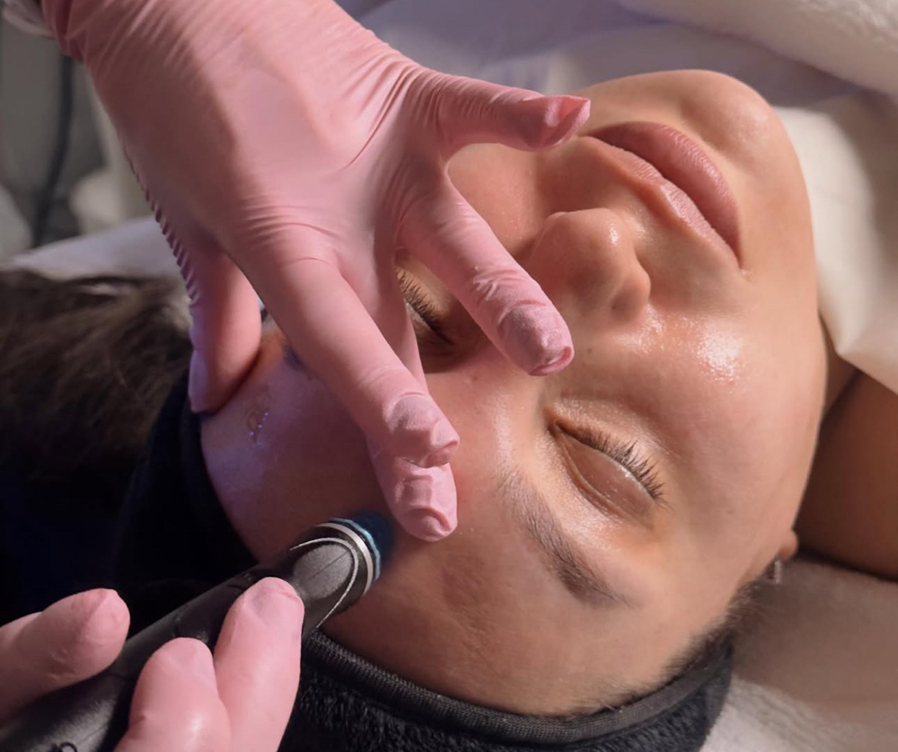 Deluxe HydraFacial Bundle