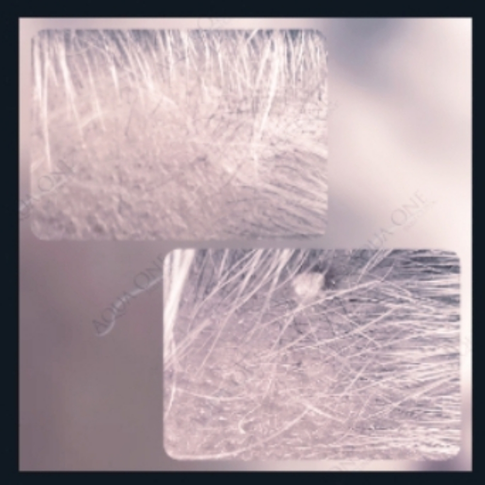 Brown Spot /Skin Tag -1 at Aqua One Skin Clinic in Jasper, IN