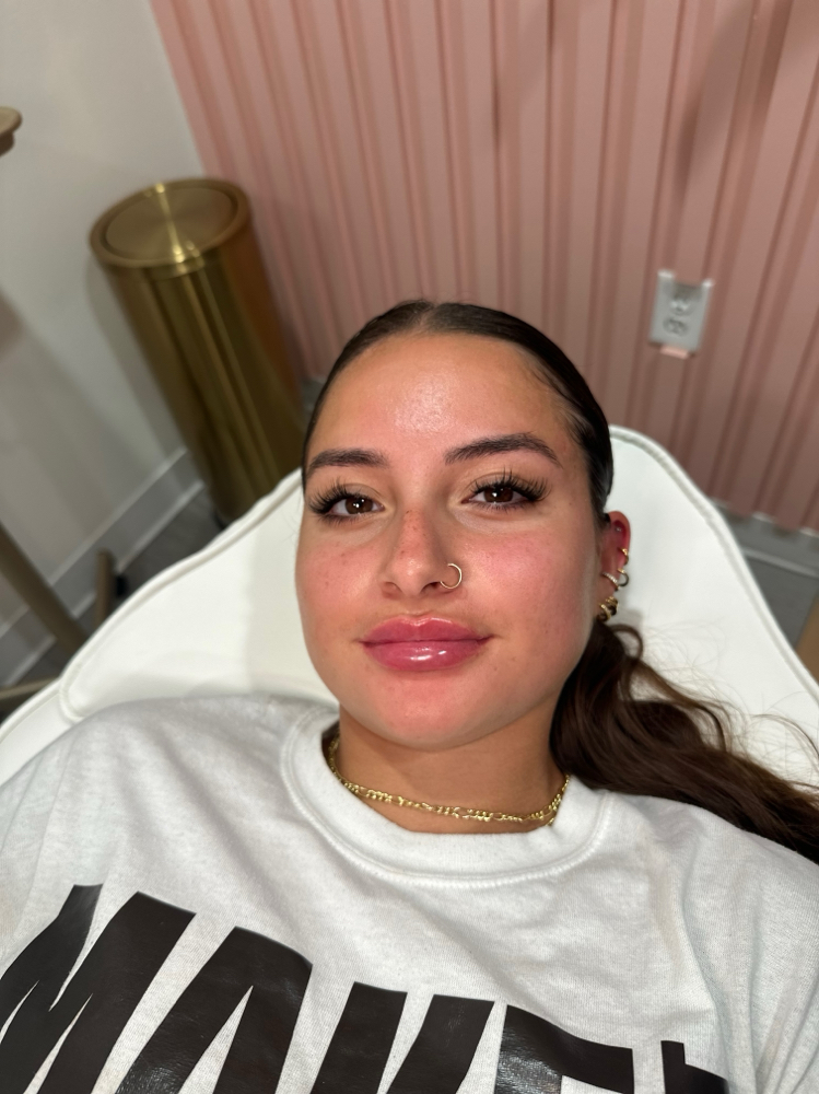 0.5ML Lip Filler