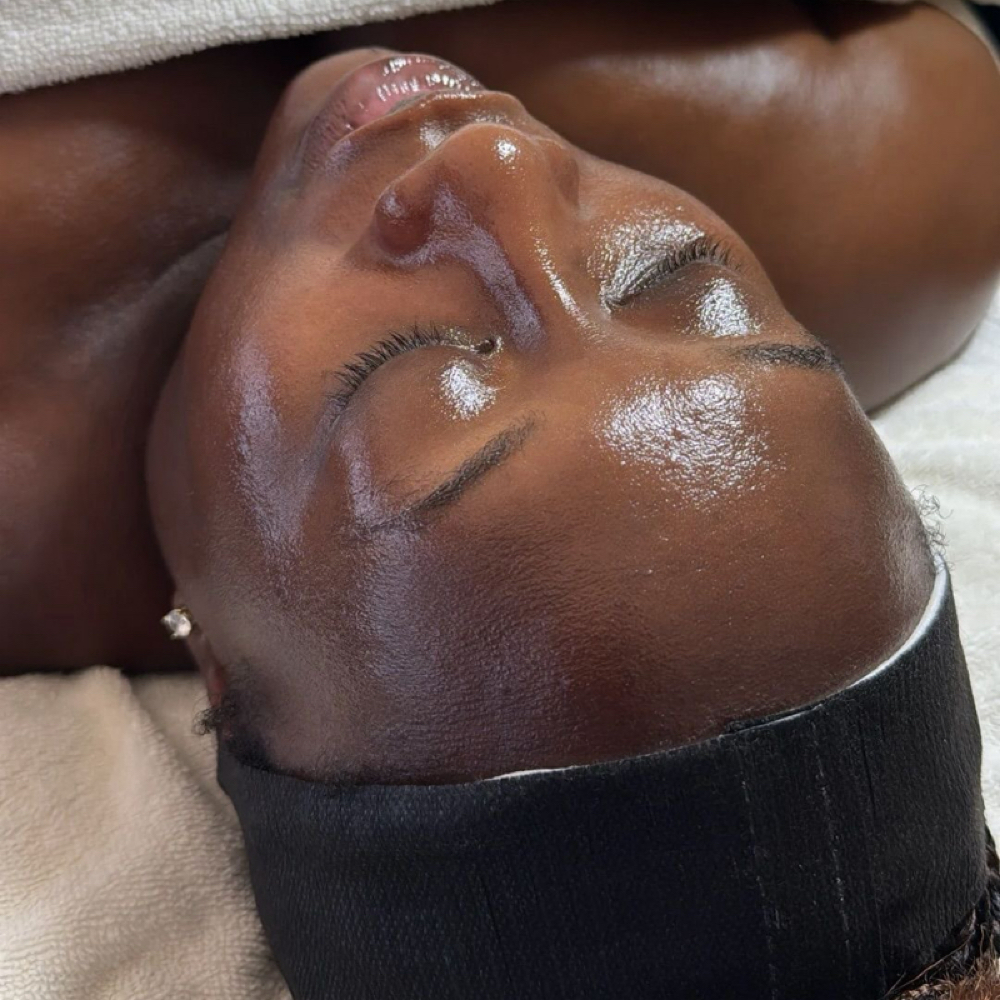 Medium peel at Nw2d Salon Fayetteville in Fayetteville, AR