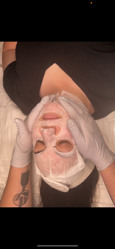 Stand-Alone Carboxy Therapy - July