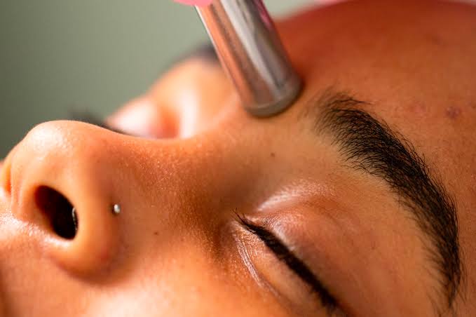 Diamond Microdermabrasion