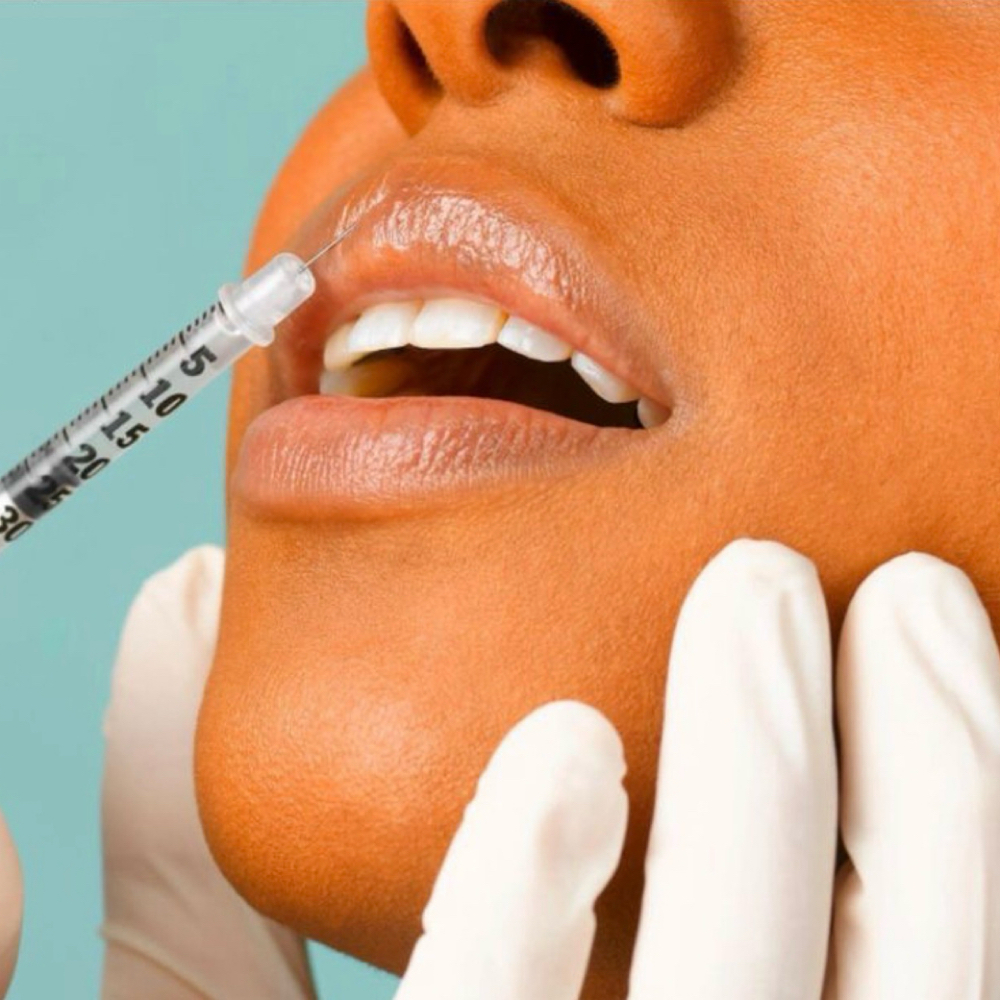 FILLER DISSOLVE SESSION