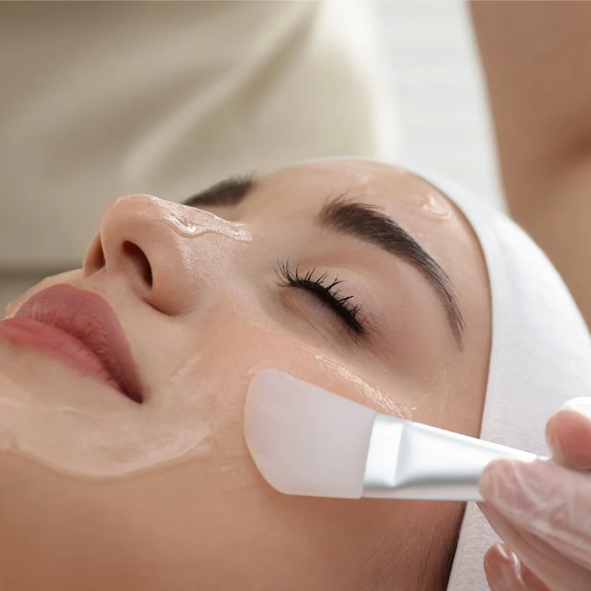 Chemical Peel