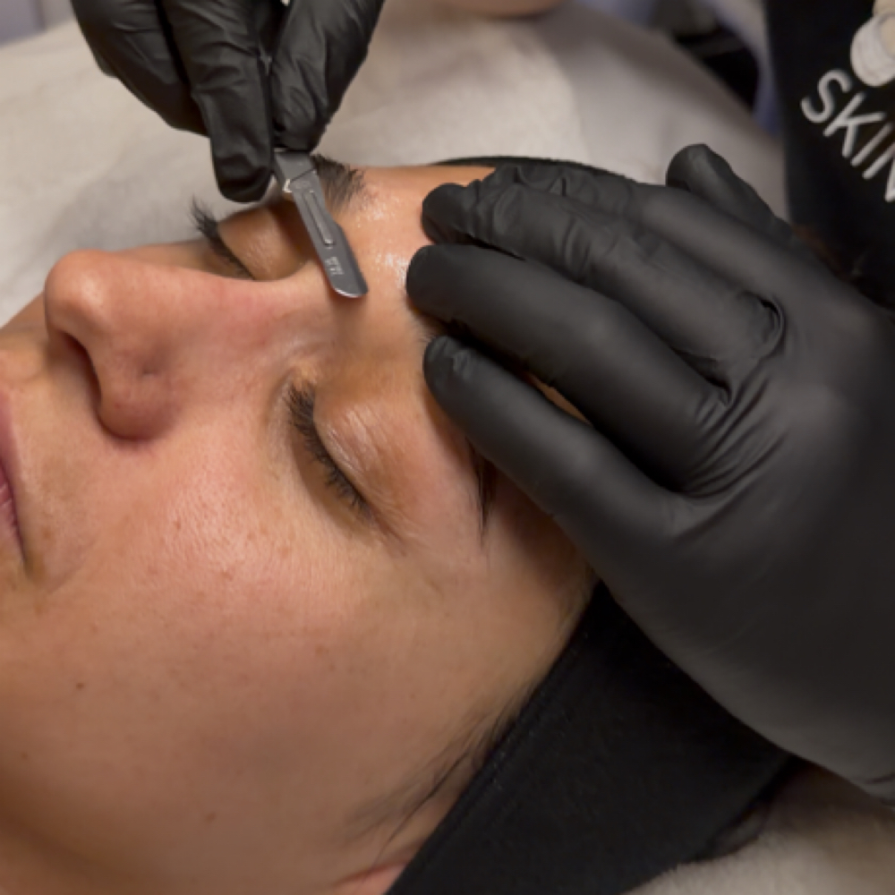The Dermaplane Glow at Desert Belle Esthetics in Albuquerque, NM