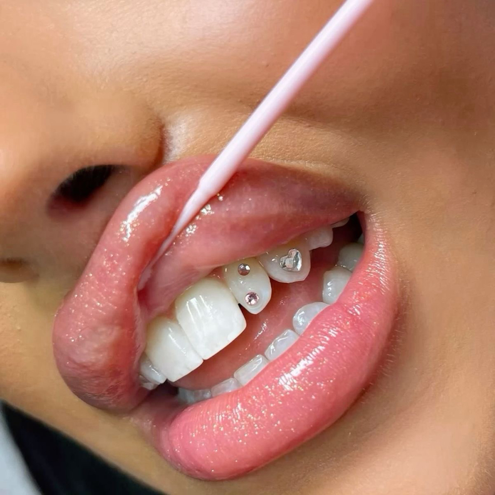 Tooth Gem Removal at Beauty Studio Jenny LLC in Meredith, NH