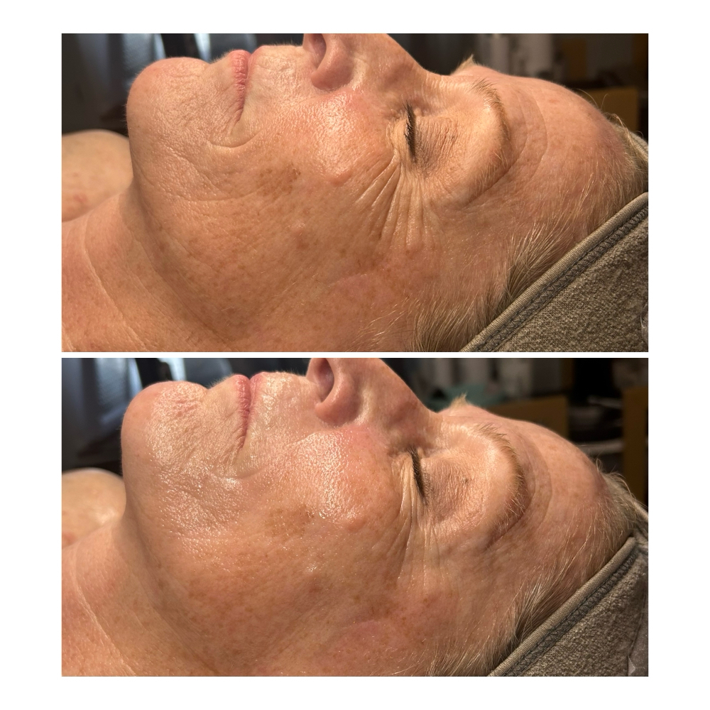 Signature Reset at Haylee Jade Esthetics LLC in Ellijay, GA