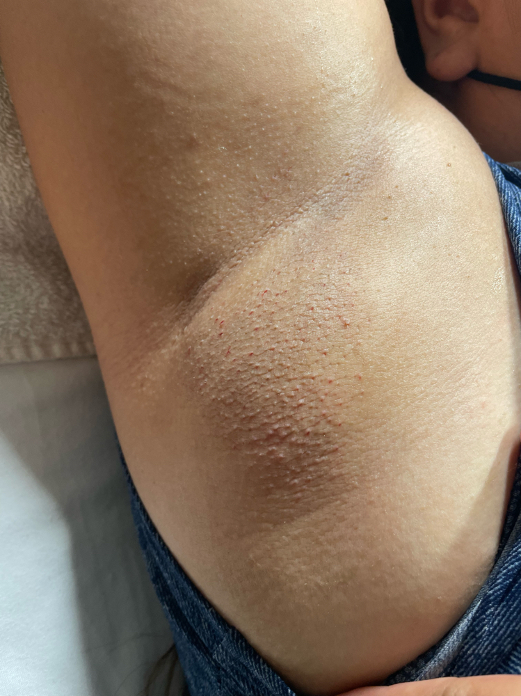 Under Arm Wax