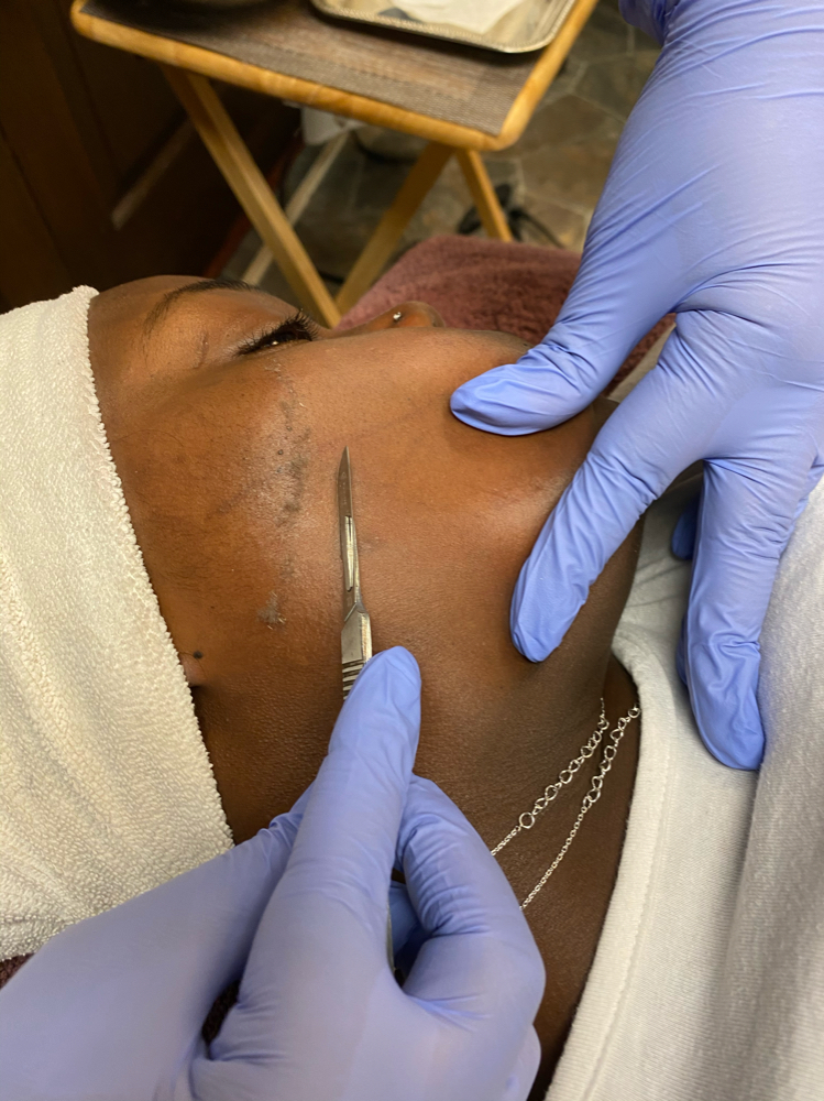 Dermaplaning Facial
